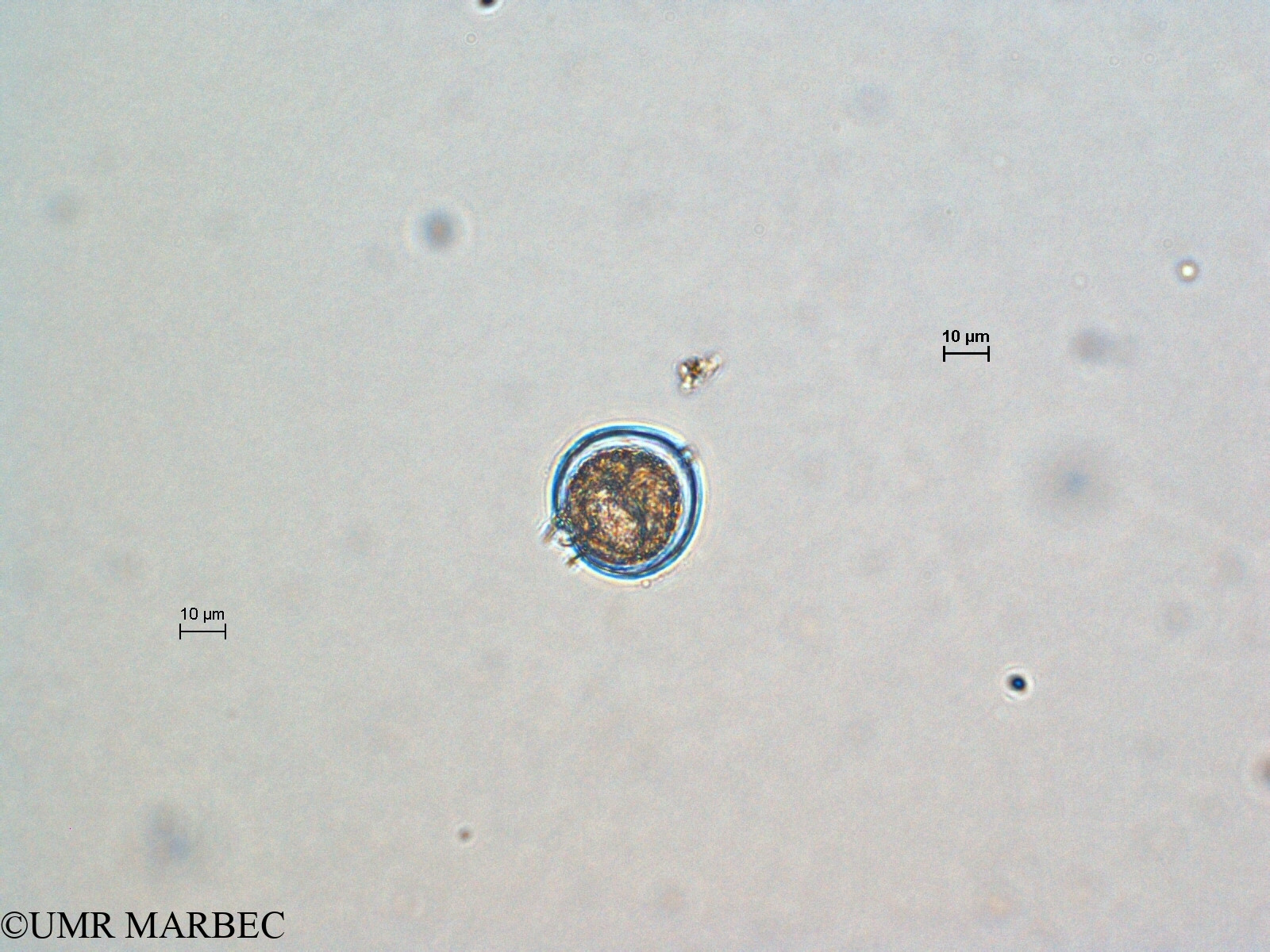 phyto/Scattered_Islands/all/COMMA April 2011/Protoperidinium sp51 (ancien Protoperidinium sp23 -ancien Protoperidinium sp9 recomposé)(copy).jpg
